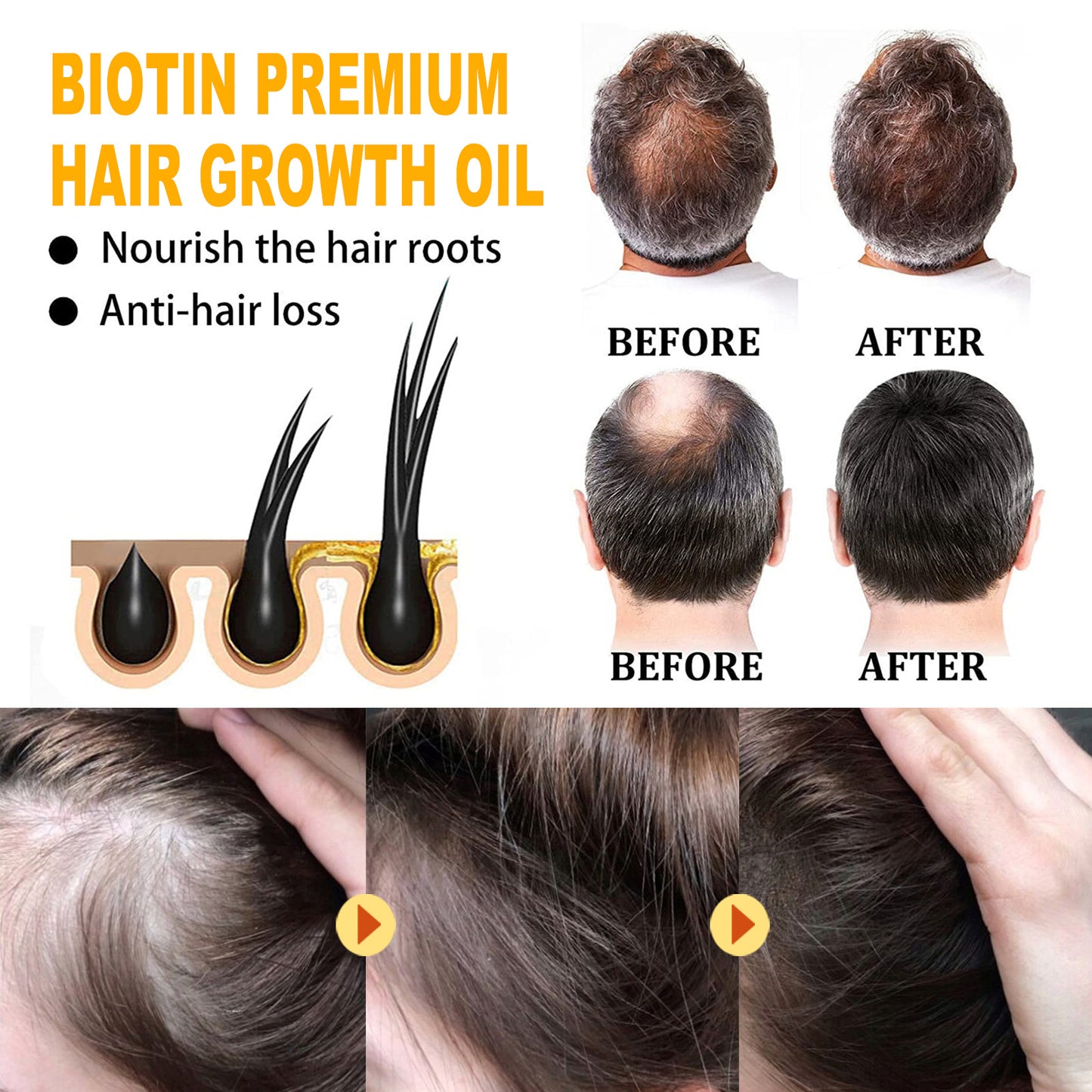 EELHOE Biotin Hair Treatment Oil Deeply Moisturizing Scalp Massage Treatment Thick And Smooth Hair Care Oil